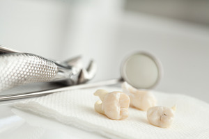 Extracted teeth lying on cloth next to dental instruments